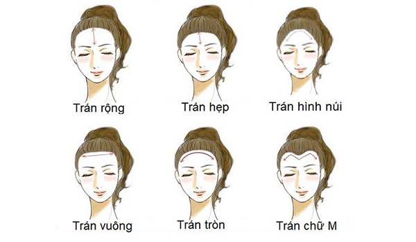 vầng trán cao
