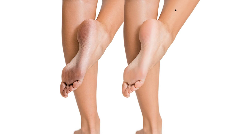 Bạn nên xóa nốt ruồi ở chân khi nốt ruồi nằm ở vị trí xấu gây ảnh hưởng đến vận mệnh
