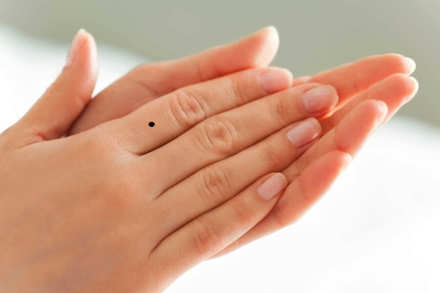 Nốt ruồi ở ngón tay trỏ